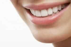 sonrisa