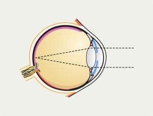 esquema de la estructura del ojo humano