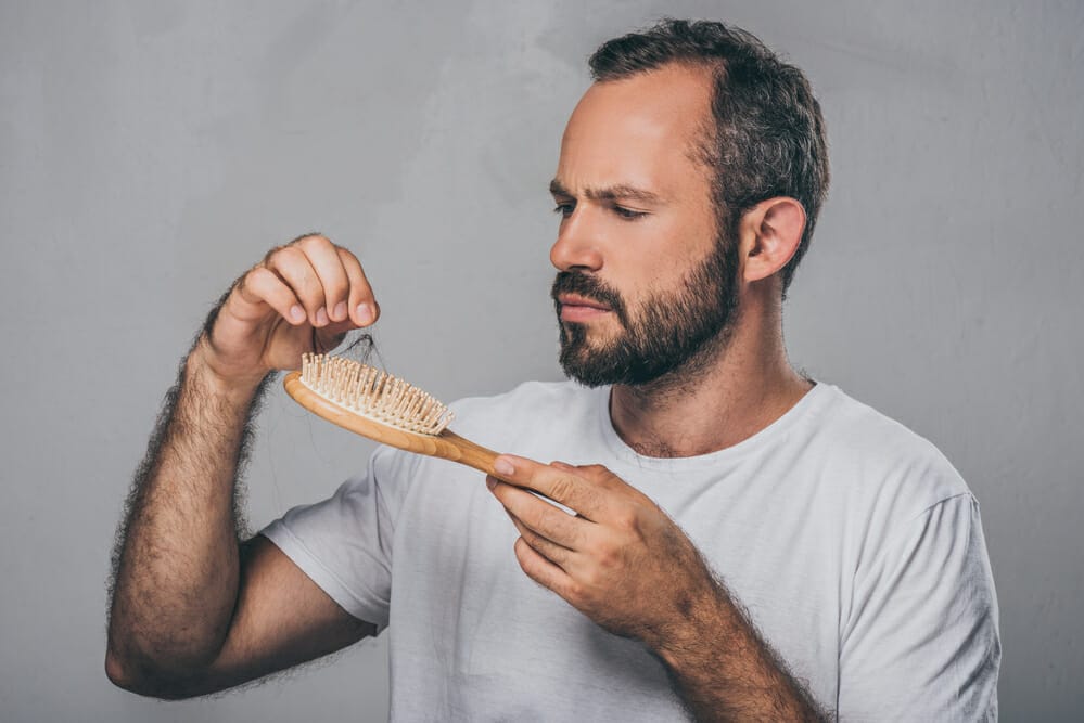  caída del cabello masculina