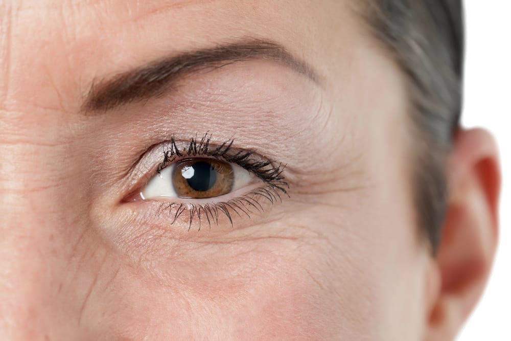 Arrugas cerca de los ojos y debajo de los ojos