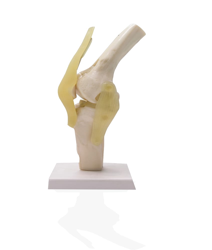 Articulación de rodilla